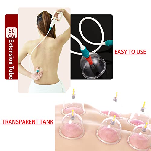 MYMM 12 Cupping Cups Sets Biomagnetic Traditional Professional Chinese Therapy Massage MYMM uk supplements