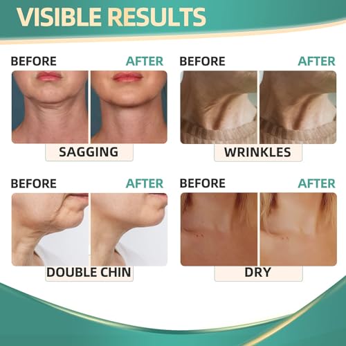 Neck Cream for Tightening Firming: Instant Face Lift Cream - Wrinkle Cream for Women RONKIE uk supplements