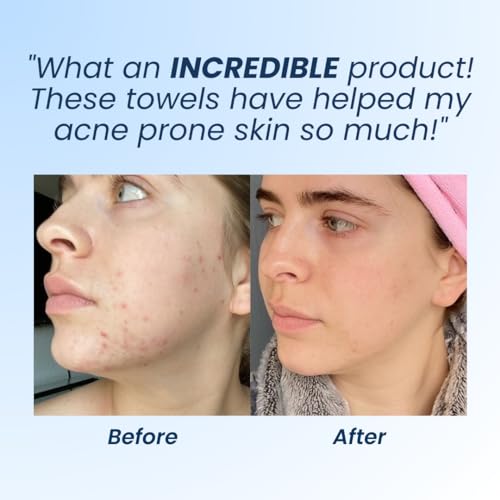 Clean Skin Club Clean Towels XL, Dermatologist Approved, 100% USDA CLEAN SKIN CLUB uk supplements