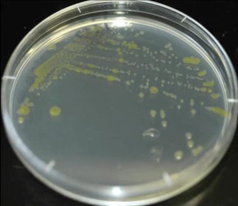 Diamante Scientific Essential Bacteria Kit. Pre-Poured Agar Plates & Swabs. Perfect for Kids. Great for Learning About Microbiology. STEM Education. Experiment Guide eBook Included! Diamante Scientific uk supplements