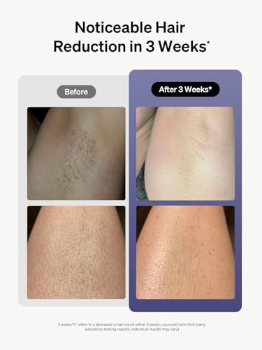 Ulike Laser Hair Removal for Women and Men, Air 3 IPL Hair Removal with Sapphire Ice-Cooling System Ulike uk supplements