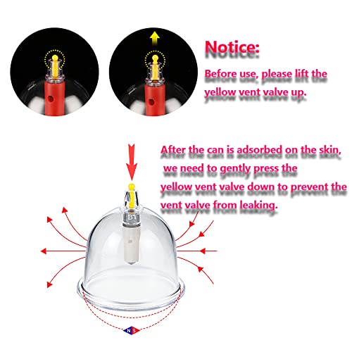 MYMM 12 Cupping Cups Sets Biomagnetic Traditional Professional Chinese Therapy Massage MYMM uk supplements