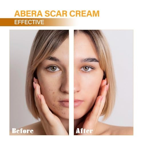 ABERA Scar Removal Cream for Women and Men - Rapid Repair of New Old Scars, Spots, Burns All Natural Treatment with Vitamin E, Alanine, Collagen (1 Box + 3 Eye Patch) ABERA uk supplements