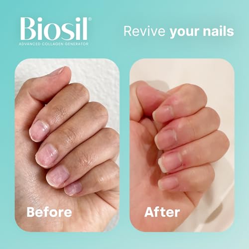 Biosil Collagen Generator - 60 Capsules - with Patented ch-OSA Complex - Generates & Protects BioSil uk supplements