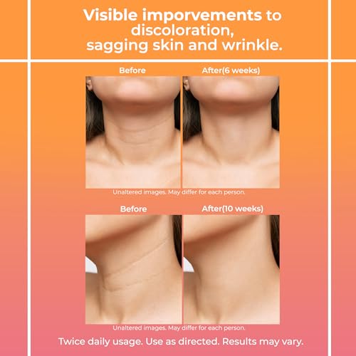 Neck Firming Cream for Women: Neck Cream - Neck Tightening Cream - Neck Creams Lemcuh uk supplements