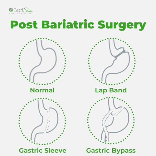 BariSlim Bariatric Calcium Citrate with Magnesium and Vitamin D Tabs - 500 mg of Calcium BariSlim uk supplements