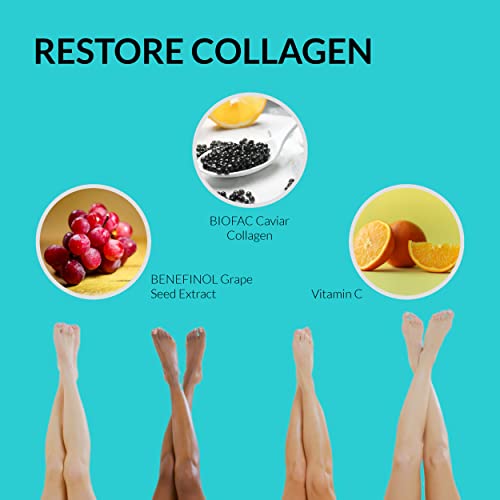 UpNourish Anti Cellulite Supplements - Varicose Veins Support, Restless Leg Relief UpNourish uk supplements