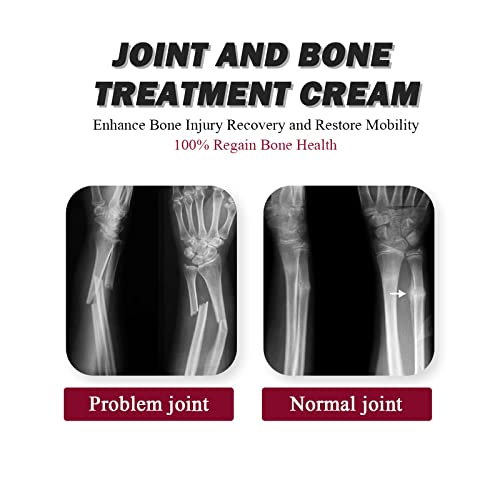 Joint Collagen Relieves Joint Soreness And Body Joint Care Collagen Get Thick Products Generic uk supplements