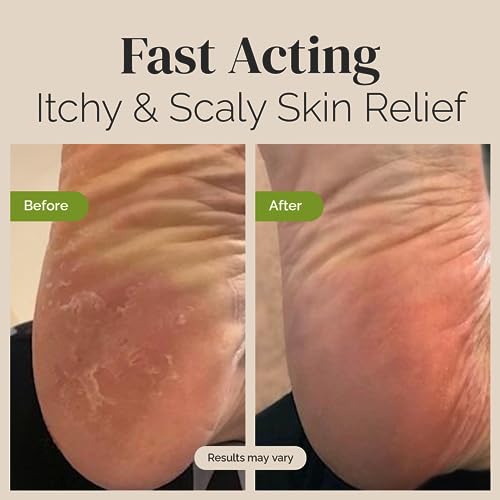 Tea Tree Oil Balm , Extra Strength, Pair Well with Jock Itch Cream, Spray, Athletes Foot Puriya uk supplements