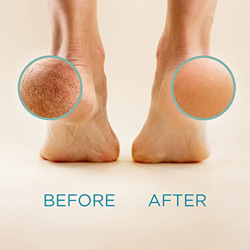Lee Beauty Professional Callus Remover for Feet - 8 Oz, Original, Powerful Lee Beauty Professional uk supplements
