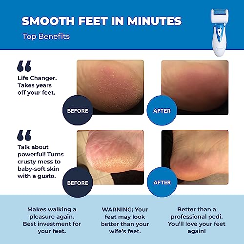 Electric Callus Remover: Own Harmony Professional Pedicure Tools Foot Own Harmony uk supplements