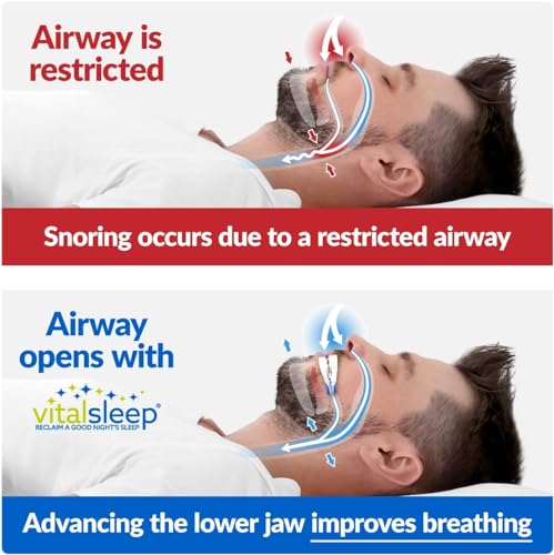VitalSleep Anti-Snoring Mouthpiece, Adjustable Jaw Positioning Vital Sleep uk supplements