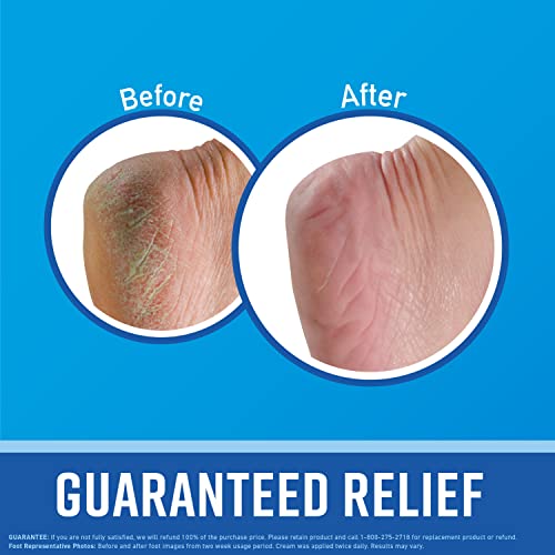 O'Keeffe's for Healthy Feet Foot Cream, 3.0 Ounce Tube and O'Keeffe's for Healthy Feet O'Keeffe's uk supplements