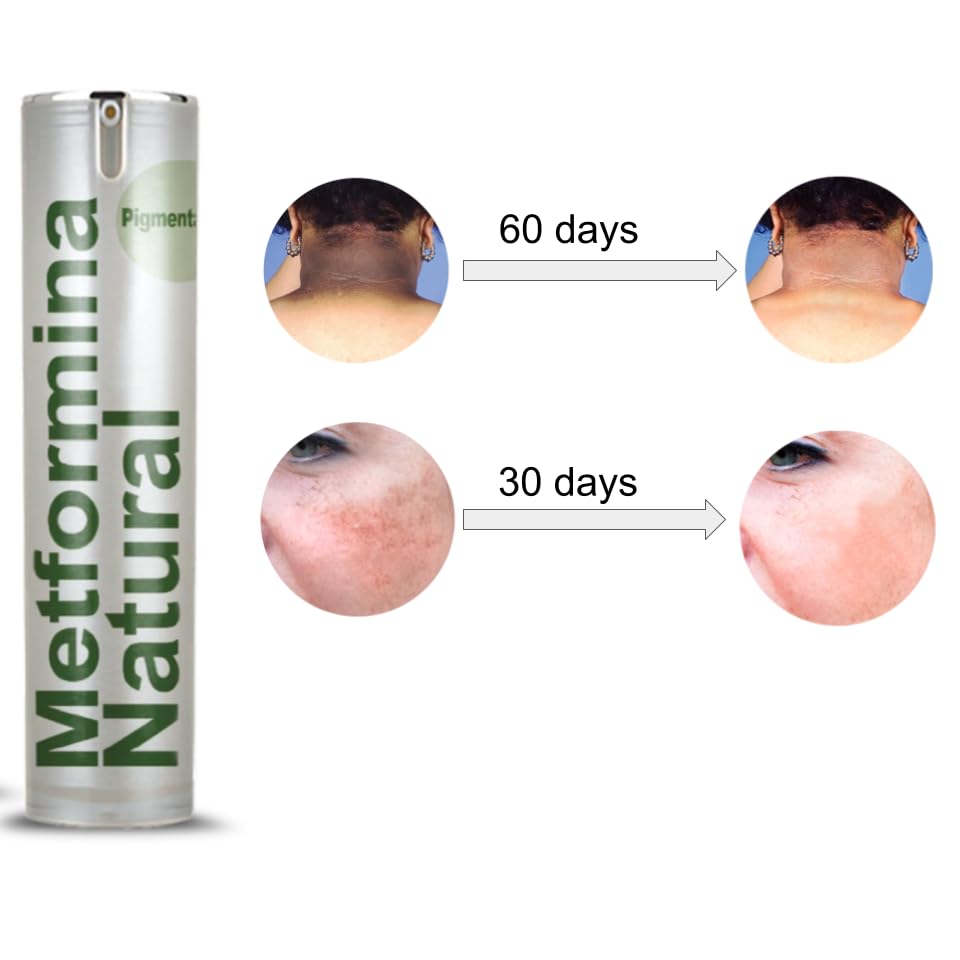 Ni una dieta más METFORMINA NATURAL - Cream for Dark Spots on Face and Body Ni una dieta más uk supplements