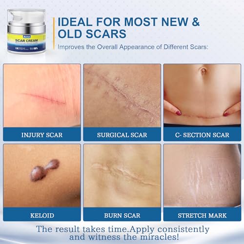 BORMSI Scar Cream,Active Silicone Dimethicone Scar Gel-Advanced BORMSI uk supplements