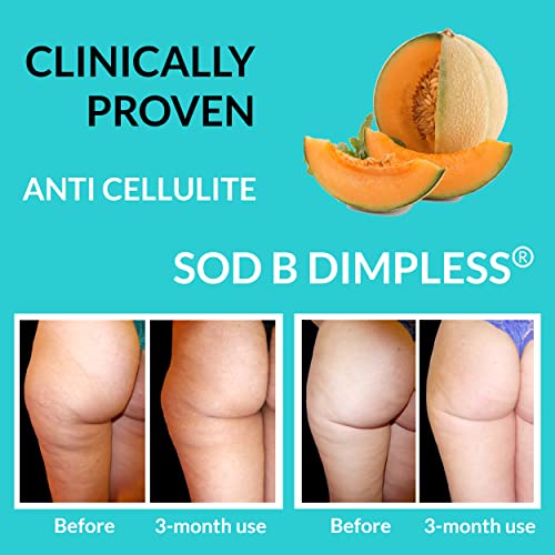 UpNourish Anti Cellulite Supplements - Varicose Veins Support, Restless Leg Relief UpNourish uk supplements