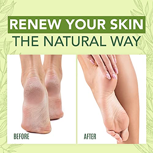 Tea Tree Oil Foot Cream For Dry Cracked Heels Repair - Natural Foot Cream For Dry Cracke USA Naturals uk supplements