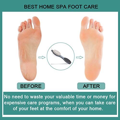 CAREHOOD Foot File Callus Remover - Multi Purpose 4 in 1 Feet Pedicure CAREHOOD uk supplements
