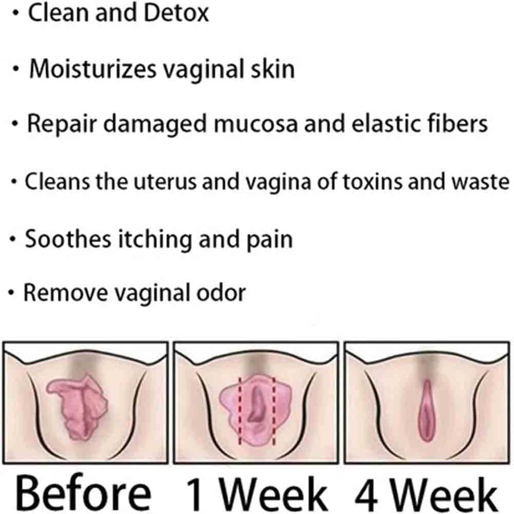 Natural Repair Vagianal Capsules, Anniecare Instant Anti-Itch Detox Slimming Products GDSAFS uk supplements