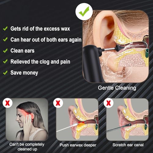 Upgraded Ear Wax Removal,Water Powered Ear Cleaner,Ear Cleaning Kit Alledge uk supplements