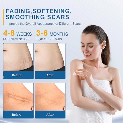 BORMSI Scar Cream,Active Silicone Dimethicone Scar Gel-Advanced BORMSI uk supplements