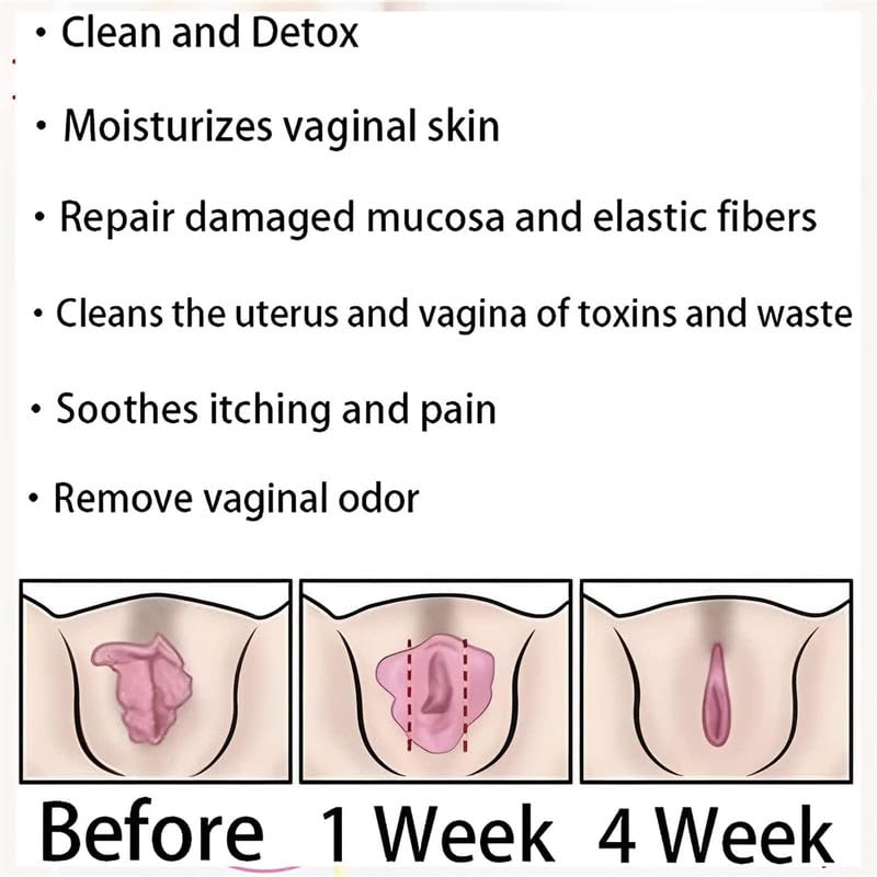 tsoneoo Dexcara Detox Repair - Natural Repair Vagianal Capsules, Natural Repair Vajinal Capsules tsoneoo uk supplements