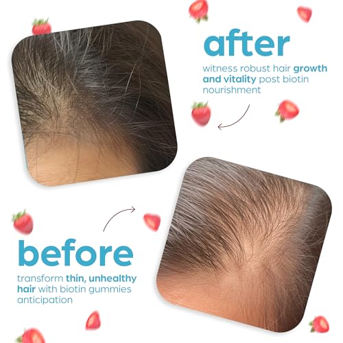 Artnaturals Biotin Gummies for Hair Growth - (100 Gummies - 10000mcg) - Natural Strawberry Artnaturals uk supplements