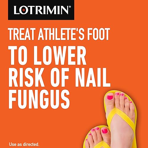Lotrimin Ultra 1 Week Athlete's Foot Treatment - Antifungal Cream, 30 Gram Lotrimin uk supplements