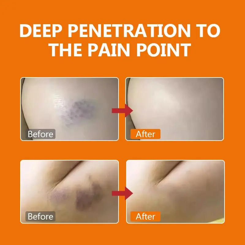 DERMFREE Pain Relief Cream DERMFREE uk supplements