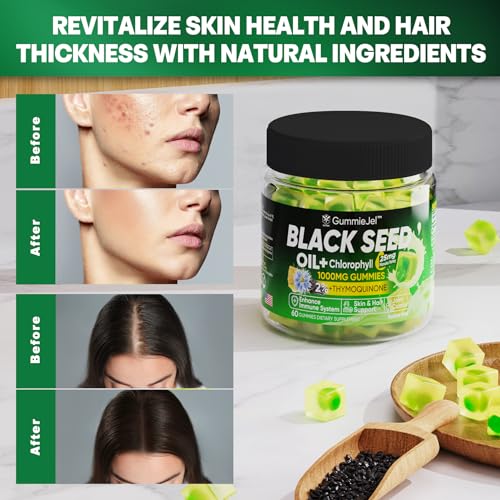 Sugar Free Black Seed Oil Filled Gummies & Chlorophyll, with Hydrolyzed Collagen EnvyCure uk supplements