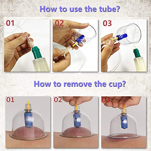 MYMM 12 Cupping Cups Sets Biomagnetic Traditional Professional Chinese Therapy Massage MYMM uk supplements
