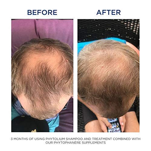 PHYTO Phytophanère 100% Natural Hair Loss Thinning Dietary Supplement PHYTO uk supplements