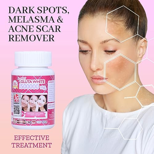 Supreme Gluta White 1500000mg for Skin Lightening, Skin Moisturizer, Collagen Stimulator Healthy Supreme Gluta White uk supplements