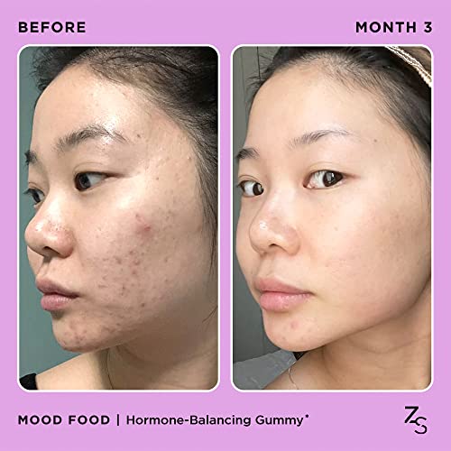 ZitSticka Mood Food: Gummy for Moody Skin + PMS Drama, Forest Berry Flavour ZitSticka uk supplements