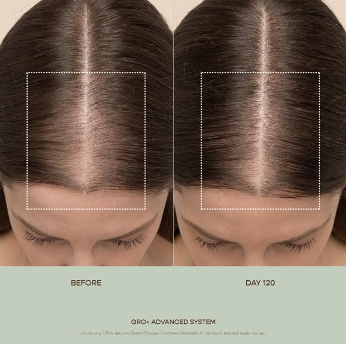 VEGAMOUR GRO+ Advanced Hair Serum for Improving Hair Density, Tonic Reduces Shedding and Promotes a Healthy Scalp, 3 pack VEGAMOUR uk supplements