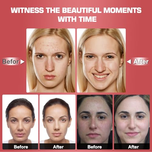 Red Light Therapy M-Ask Red Light Facial M-Ask Red Light Therapy for Face 7-1 Colors Light for Face Home Use LORICK uk supplements