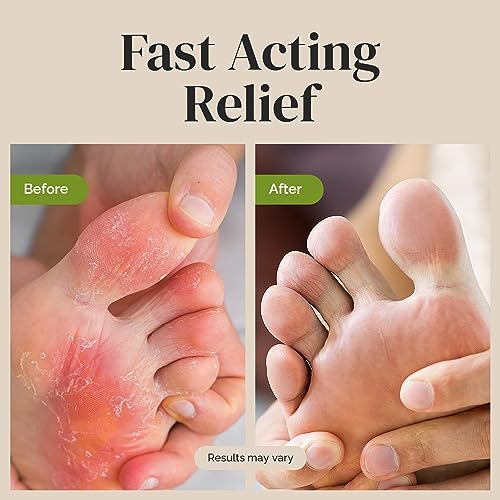 Puriya Tea Tree Oil Antifungal Cream, Plant-Powered Athletes Foot Cream Treatment Puriya uk supplements