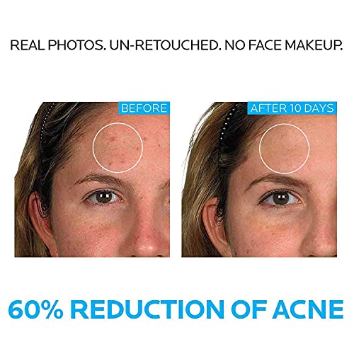 La Roche-Posay Effaclar Dermatological 3 Step Acne Treatment System La Roche-Posay uk supplements