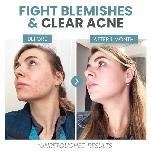 Eva Naturals Vitamin C Face Serum With Hyaluronic Acid - Anti Aging Serum Eva Naturals uk supplements