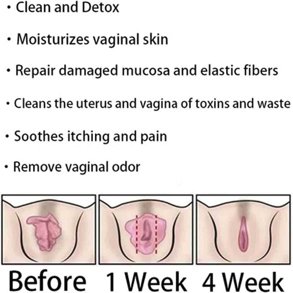AnnieCare Instant Anti-Itch Detox Products, Annie Care Capsulas, Firming Repair & Pink Weabet uk supplements
