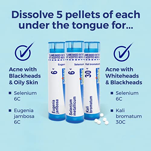 Boiron Acne Relief Kit for Blackheads, Oily Skins, Whiteheads on The Face and Body - 3 Count (240 Pellets) Boiron uk supplements