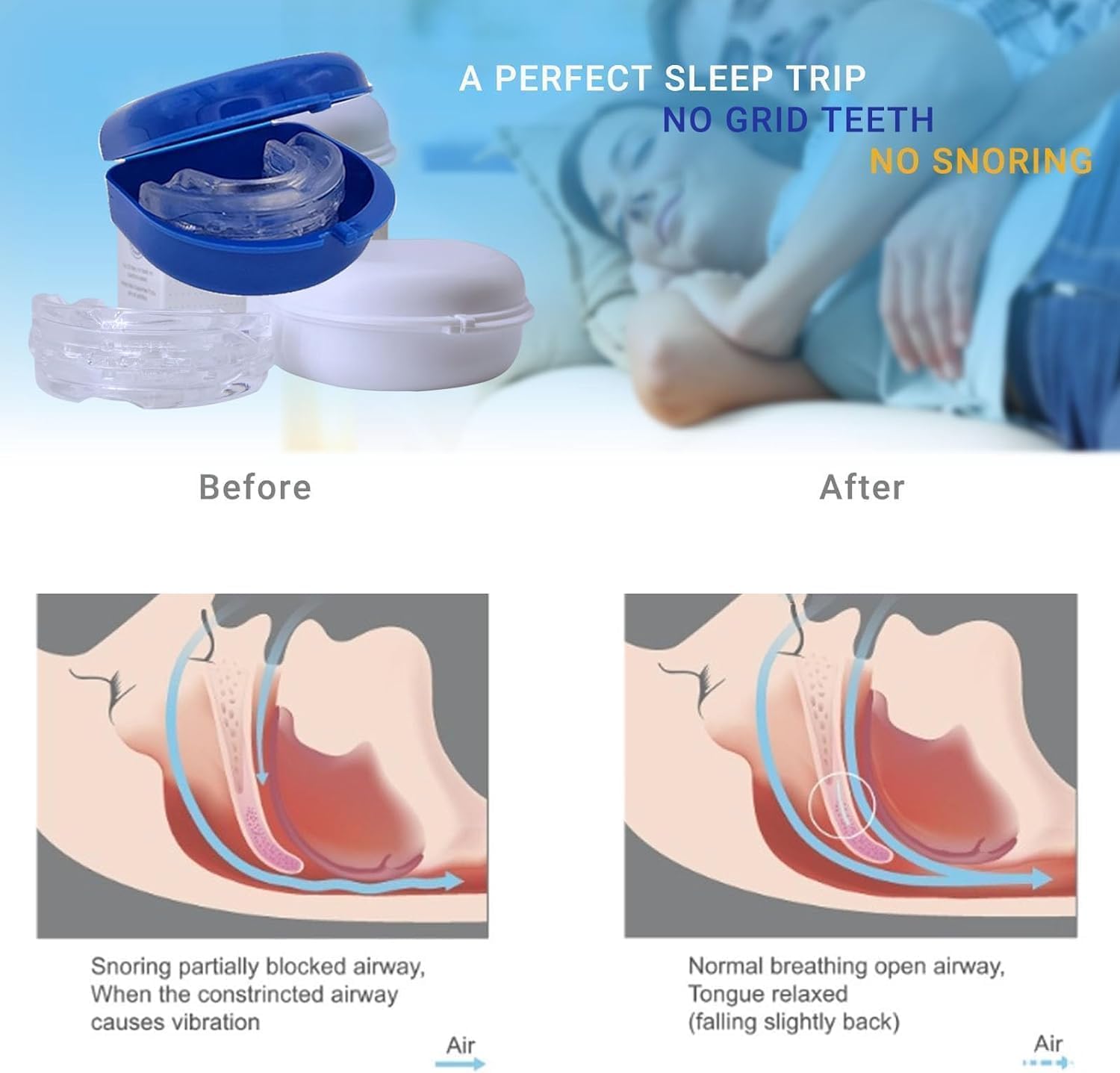 SereneSleep Mouthpiece (Blue) BAWOTY uk supplements