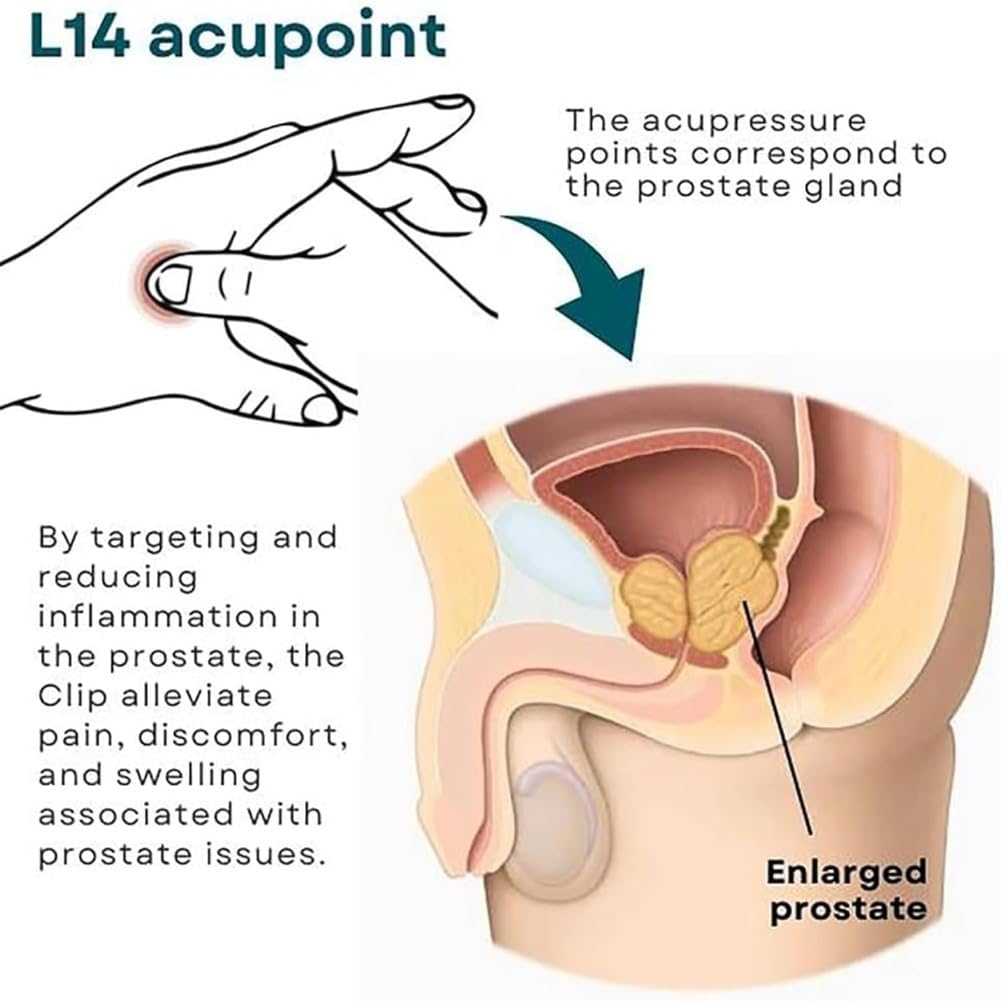 2pcs Prostate Care Point Clip for Men,Acupressure Hand Pressure Point Clip, Relieve Prostate DEFUAUKE uk supplements