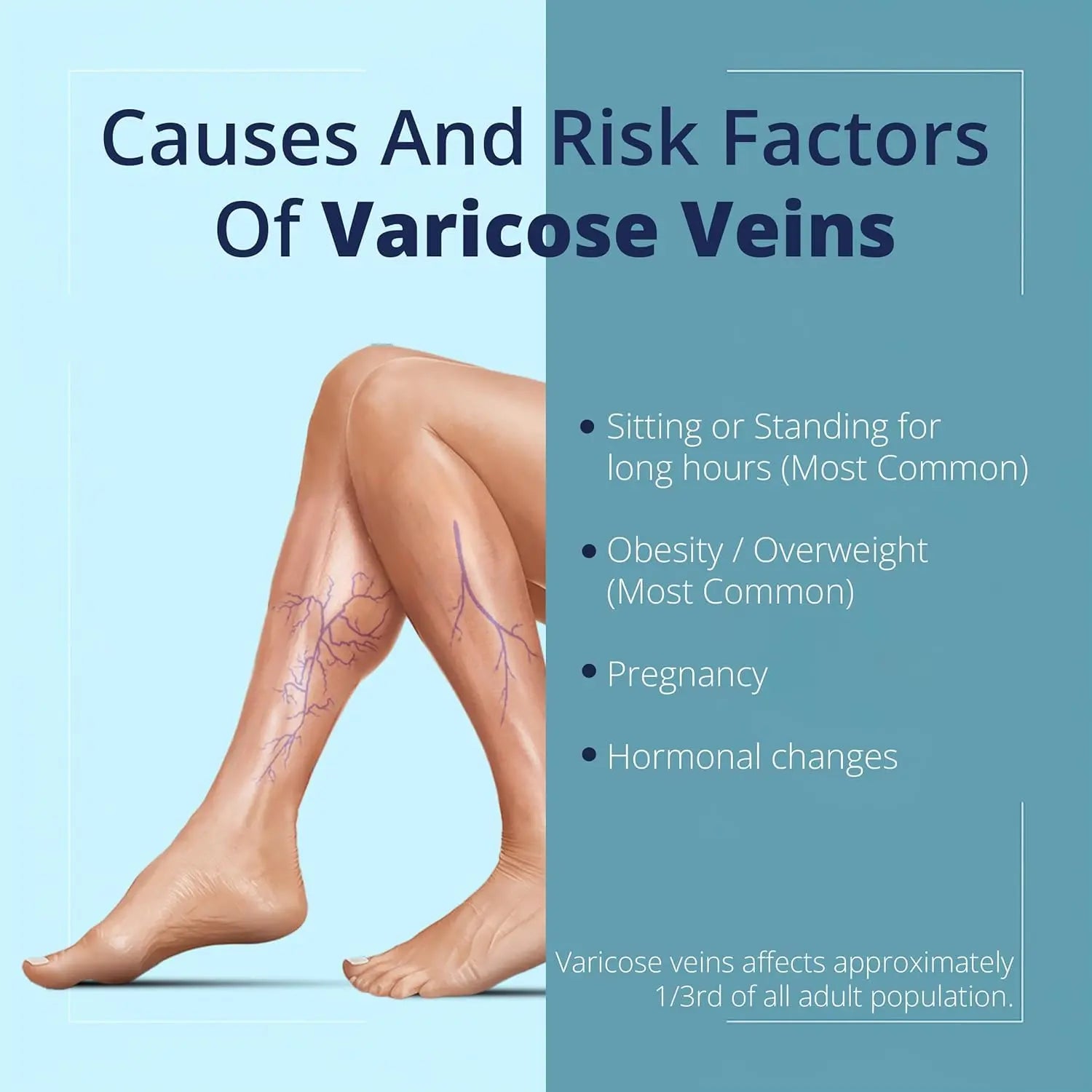 Cream Ayurvedic Solution for Management of Varicose Veins, Spider Veins, Varicocele Helps Reach The Root Cause of varicose Veins Reduces Cramps, Itching & Swelling. Single Tube (25 GMS). Generic uk supplements