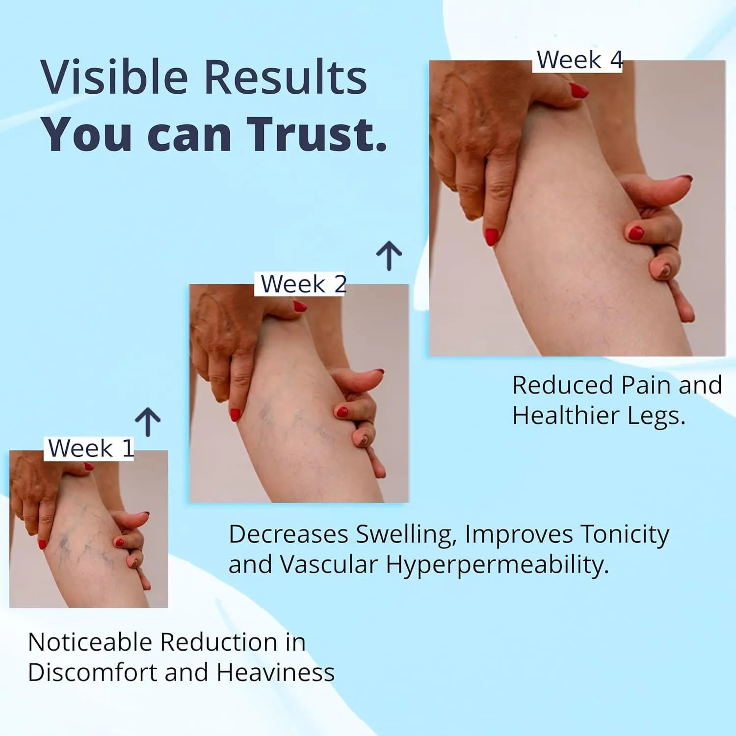 Cream Ayurvedic Solution for Management of Varicose Veins, Spider Veins, Varicocele Helps Reach The Root Cause of varicose Veins Reduces Cramps, Itching & Swelling. Single Tube (25 GMS). Generic uk supplements