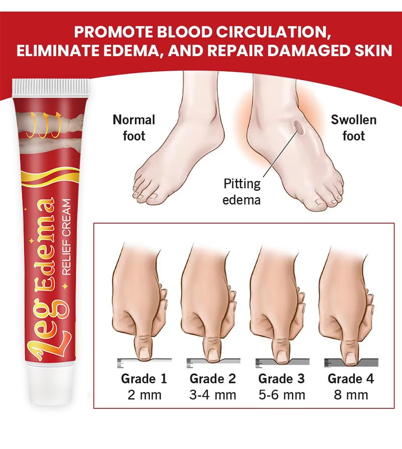 Leg Slimming Massage Cream | Soothing Swelling, Tightening Skin, Auxiliary Care for Reducing Edema （2 Pieces） bobojuju uk supplements