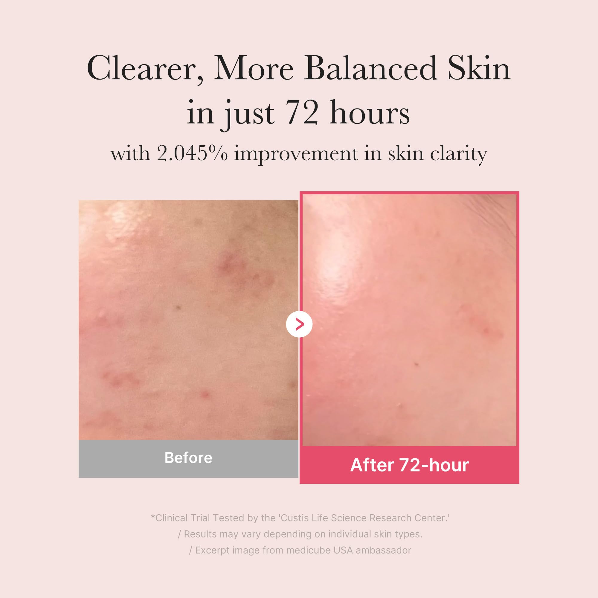 medicube TXA+Niacinamide 15% Glow Facial Serum for After Spot Care | All-in-One Daily Korean Skincare | Uneven Skin Tone, Texture, and Hydration Care | High-Potency Tranexamic Acid 5% | 1.01 fl.oz medicube uk supplements