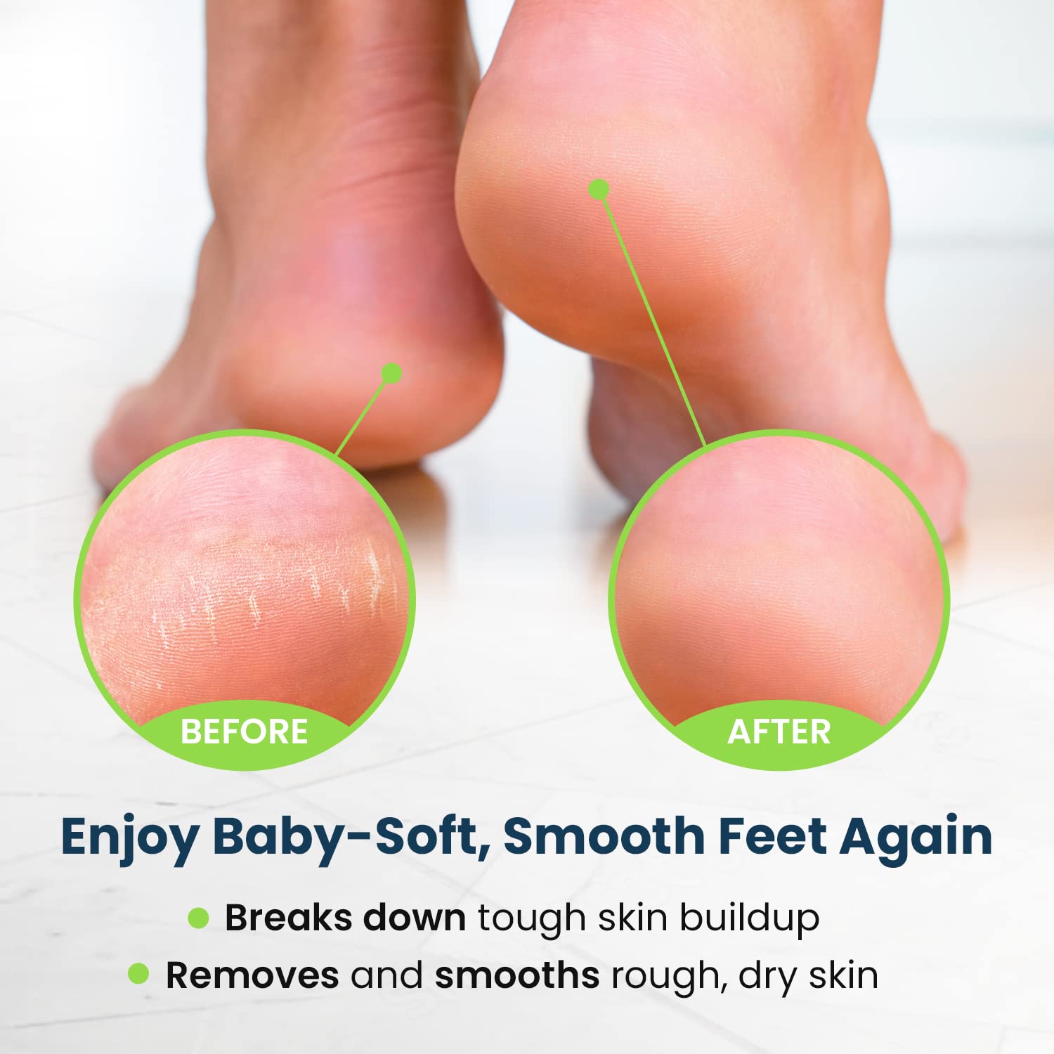 Toenail Fungus Treatment Extra Strength - Advance nail fungus treatment for fingernails FOOT CURE uk supplements
