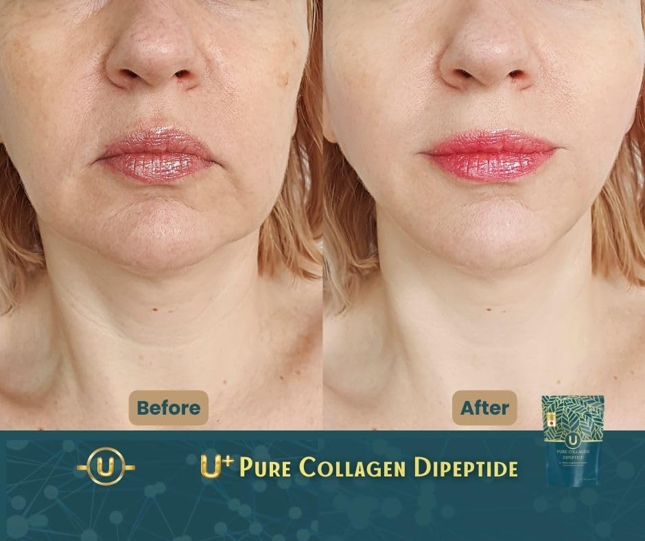 U+ Pure Collagen Dipeptide Supplement - Advanced Hydrolyzed Collagen Powder for Skin, Hair U+ Pure Collagen uk supplements