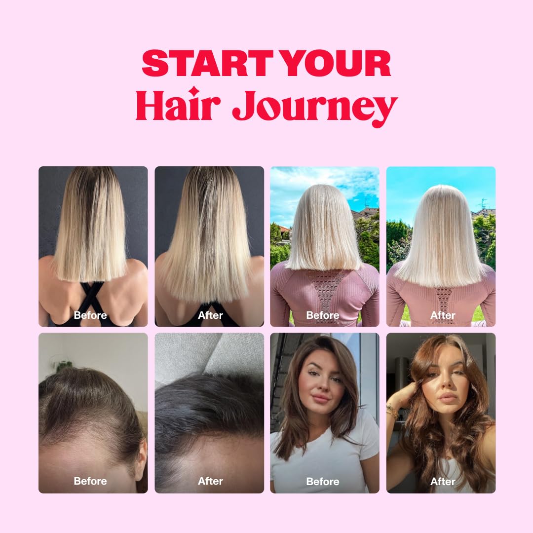 Bloom Robbins 60 Hair Gummies for Faster Hair Growth Vitamins for Women & 5000 MCG Bloom Robbins uk supplements